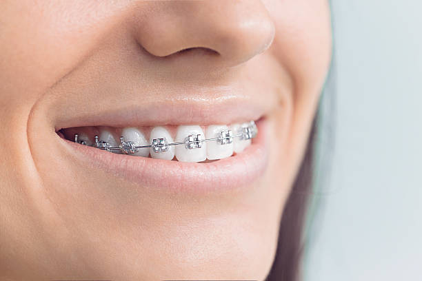 Full Mouth Reconstruction in Middleton, ID